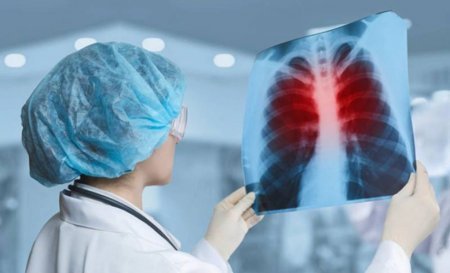 Bu qida ağciyəri təmizləyir Bu qida ağciyəri təmizləyir